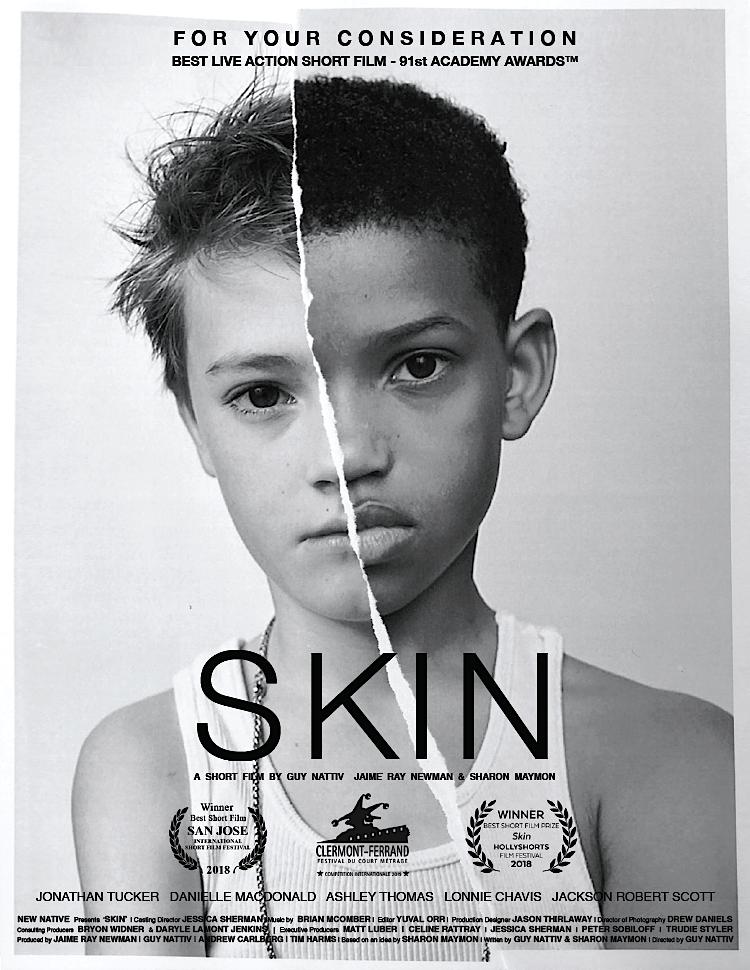 En İyi Kısa Film: Skin